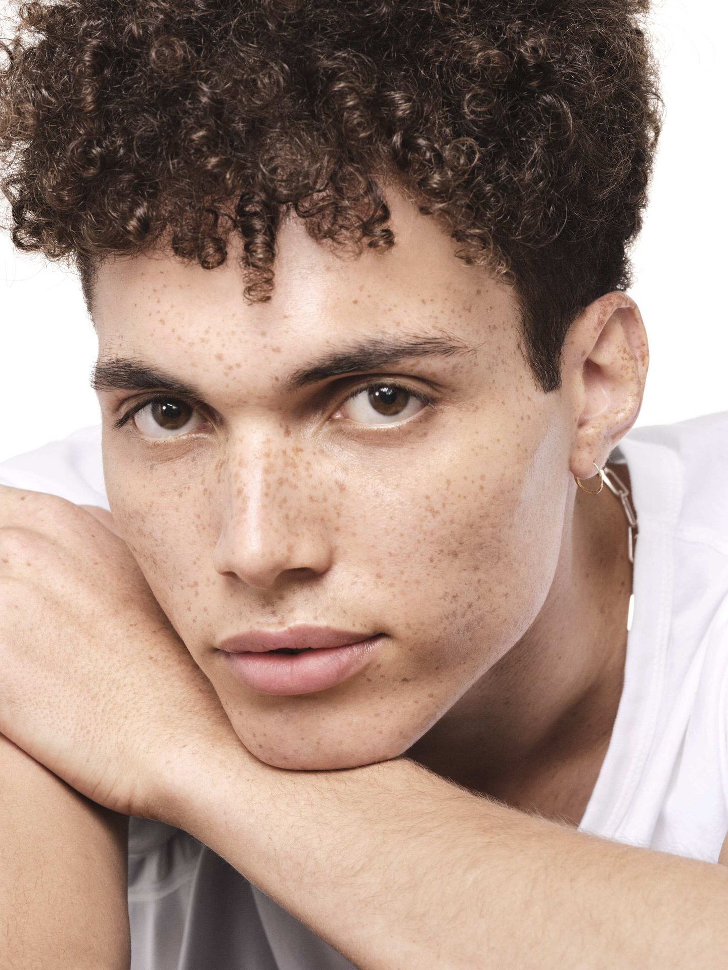 winter-acne-how-to-manage-imperfection-prone-dry-skin