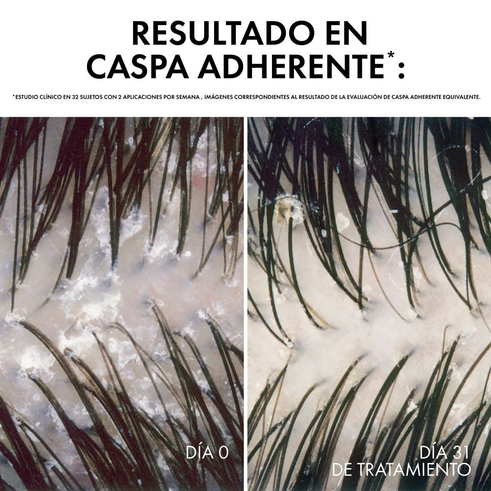 DERCOS ANTI-DANDRUFF DS SHAMPOO REFILL NORMAL TO OILY HAIR